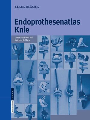 cover image of Endoprothesenatlas Knie